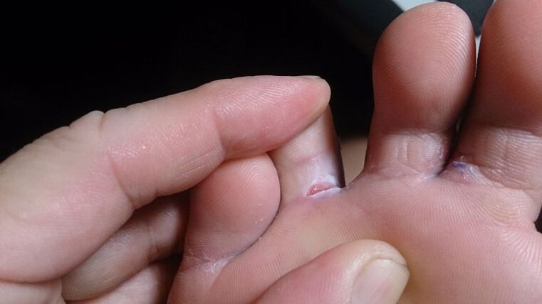 Mushroom between the fingers