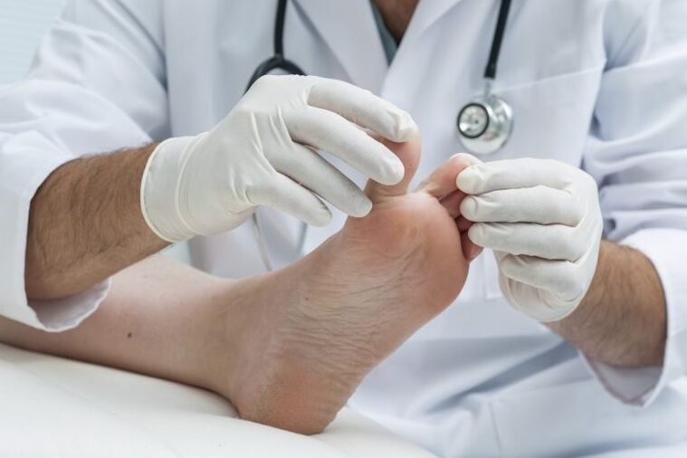 The doctor's examination by the presence of mycosis