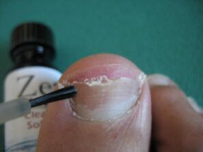 Apply lacquer
