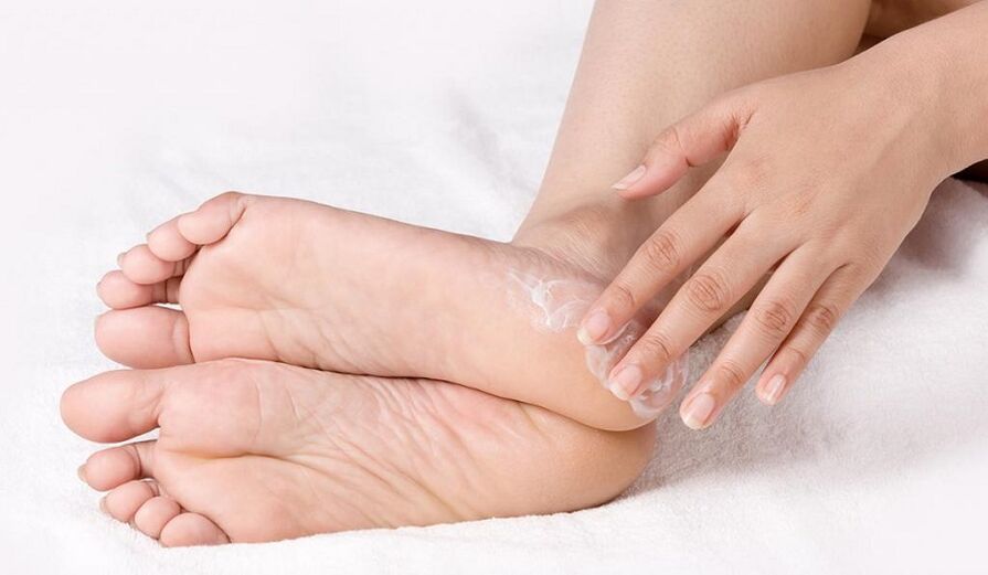 Treating athlete's foot with ointment
