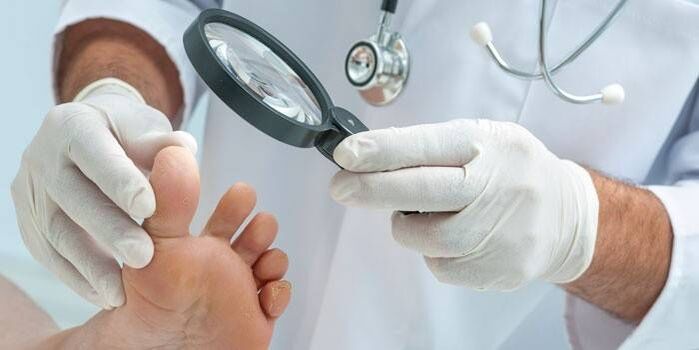 The doctor examines the feet for fungus between the toes